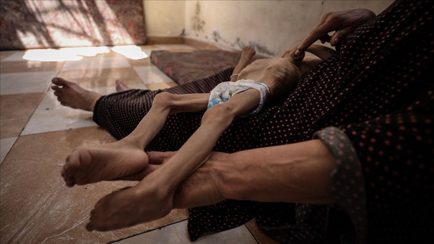 İsrail’in kıtlığı dayattığı Gazze’de son 24 saatte 2’si çocuk 5 kişi daha açlıktan hayatını kaybetti