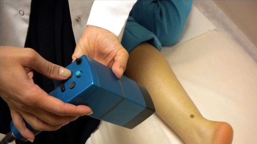 Araştırmaya göre, solaryuma girmek melanoma yakalanma riskini neredeyse üç kat artırıyor